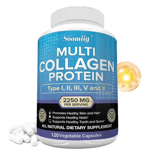 High Strength Collagen Complex - Protein Supplement for Firm Skin, Healthy Joints, Hair and Nails, 120 Capsules