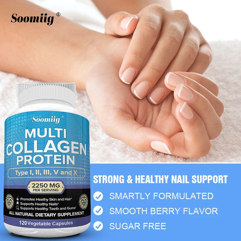 High Strength Collagen Complex - Protein Supplement for Firm Skin, Healthy Joints, Hair and Nails, 120 Capsules